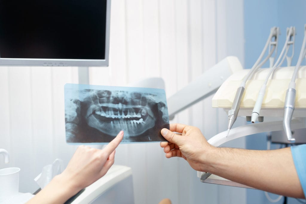 A dentist holds a dental x-ray out to show a patient they also have unscheduled dental treatment plans.