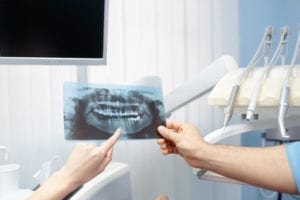 A dentist holds a dental x-ray out to show a patient they also have dental needs. The dentist wants to prevent this patient from becoming a patient with unscheduled dental treatment plans.