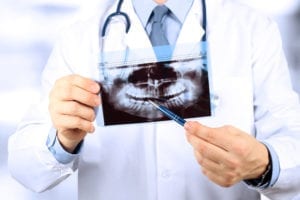 A dentist holds a dental x-ray and points to an area of a patient's mouth that needs treatment. There are many patients with unscheduled treatment plans.