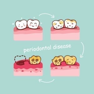 Dental Office Periodontal Procedures Tracked Separately In The Dental Office Improve Dental Office Scheduling