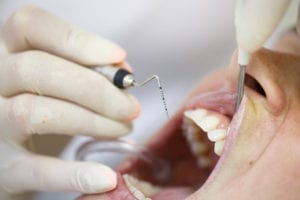Periodontal pocket measurements must be included with many periodontal dental insurance claims